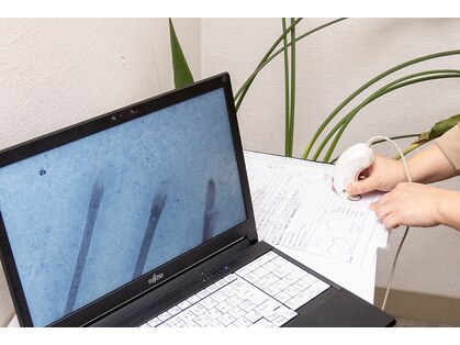 スカルプラボ(Scalp Lab)の写真