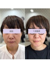 ダリア(Dahlia)/満足度★引き締め80shot→1回後