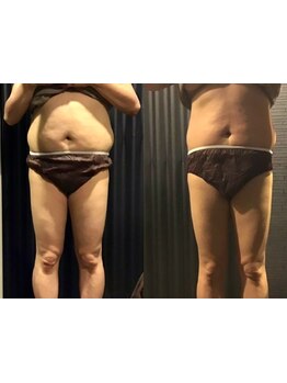 サイズダウンを目指したい