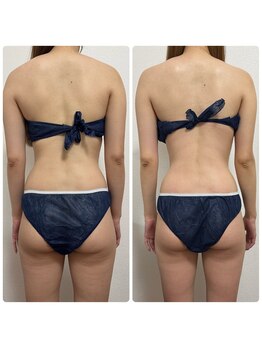 エステサロンブランシュ(Esthe salon Blanche)/ブライダルボディトリートメント