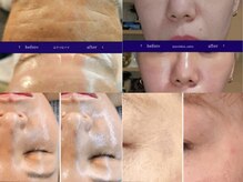 ティア(TIA)の雰囲気(毛穴洗浄・ハーブピーリング等フェイシャルメニューも豊富)