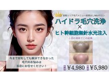 リューズ クラブ ビューティー(Ryuzu Club Beauty)の雰囲気（【無針水光注入】痛みなし/ダウンタイムなしで注入します♪）