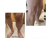 テンピスモ(tempismo)/before after