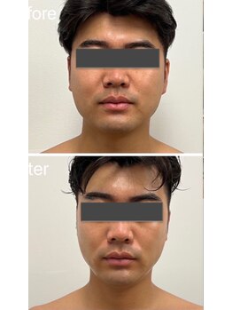 サロン ド レーヴ(Salon de Reve)/【お客様の事例】Billy’s Care