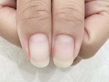 ネイルアロマ(Nail AROMA)の写真/年齢問わず爪の深い悩みを抱える方へ！自爪の良さを最大限引き出す本格ハンド・ネイルケアをお届けします◎