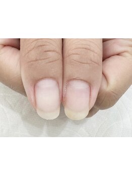 爪の悩みを解消できる（ケア含む）