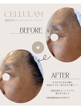 シェリア 桜新町/シワも劇的変化