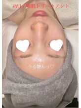 エン(en.)/REVI陶肌トリートメント