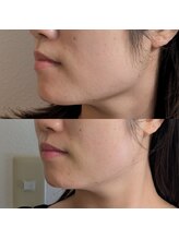 ディオーネ 岡崎店(Dione)/《テラボーラー》Before-After