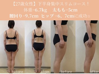 エターナルフレーム(Eternal Flame)/27歳下半身集中スリムコース