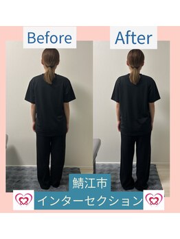 腰の整体インターセクション/美容整体