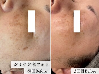 リコス(LICCO’S)