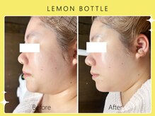 シロカネ 光の森店(SHIROKANE)/レモンボトル☆