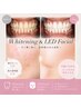 細胞活性化LEDフェイシャル30分＋ハイパワーホワイトニング20分×1