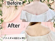 プラディンケリエ