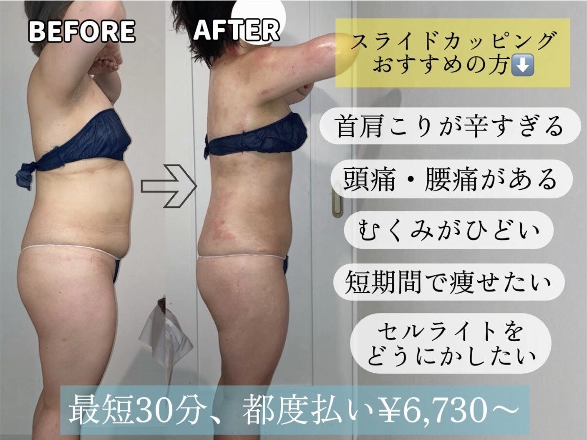 スピード美人 新宿店｜ホットペッパービューティー