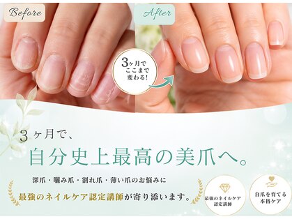 ラウレア(laule'a)の写真