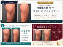 ルネアススパ 南青山(Lune’as Spa)の雰囲気（痩せるのに必要だったのは身体にスイッチを入れる事だけだった！）