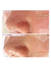 ドレッサー(Dresser)/SNSを調べすぎないで下さいね