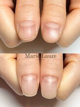 マリーロール 梅田店(Marie Laure)/自爪育成/深爪矯正/ネイルケア