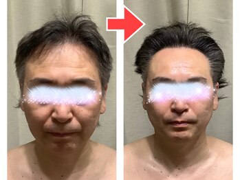 エスボニータ(es bonita)/●小顔コルギ