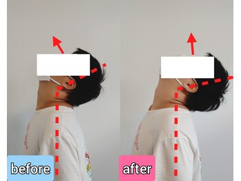 エンビジョン(ENVISION)/before→after