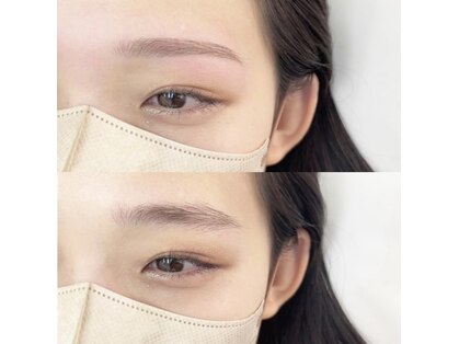 エルブリンク(elblink)の写真