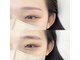エルブリンク(elblink)の写真