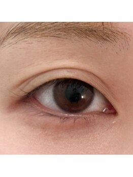 ネロ(nelo.)/before