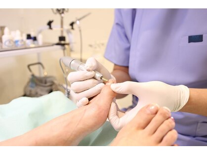 巻き爪補正店 松本店の写真