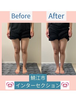 腰の整体インターセクション/美容整体
