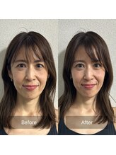 プラスアルファ(PLUSALPHA)/