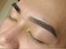 ジェニック(_genic)/メンズ脱毛