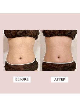 ミーティス/30代のお客様♪