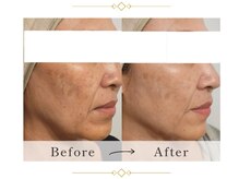 アマリー(Amary)の雰囲気（光フォトでシミ・くすみをケア◎透明感ある素肌へ）