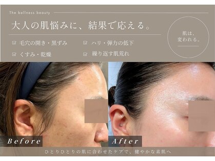 ザ ベルネスビューティー(The bellness beauty)の写真