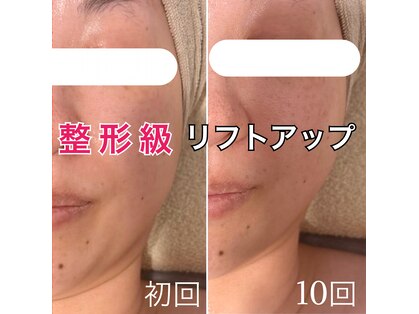 からだ美人 ヘッドスパ 鹿児島の写真