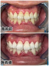 ホワイトニングビューティー 名古屋栄店(WHITENING BEAUTY)/セルフホワイトニング