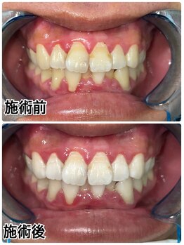 ホワイトニングビューティー 名古屋栄店(WHITENING BEAUTY)/セルフホワイトニング