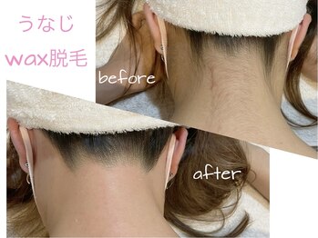 サロン ド モモ(salon de momo)/うなじデザインwax脱毛