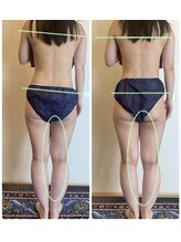 ローズ 下松(ROSE)/【骨盤歪みも筋膜リリースで】