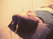 ハル 香芝院(haru)/あたまの鍼＋ヘッドマッサージ付