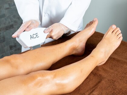 エース(ACE)の写真