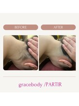 グレイスボディ ヨークタウン坂東店(Grace Body)/うなじ脱毛