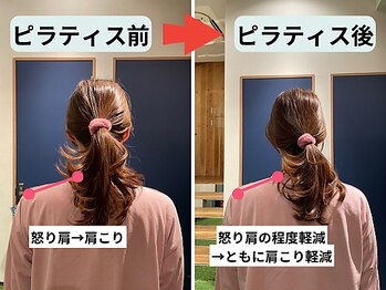 ファクト(fact)/怒り肩、慢性的な頭痛や首肩こり