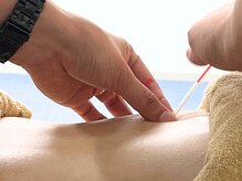 アポロ鍼灸マッサージ接骨院の雰囲気（鍼灸でつらい肩首こり・腰痛を根本改善◎）