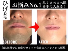 ジェントルメンズグロー(Gentlemen’s Glow)