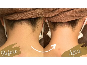 チャンティック(Cantik)/うなじケア