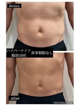 ナムズ(Nams)/【お腹】オーダーメイド痩身