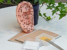 耳のツボに金粒を貼るので痛みゼロで目立たない♪